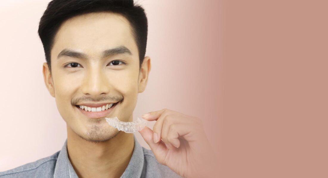 Invisalign Discount