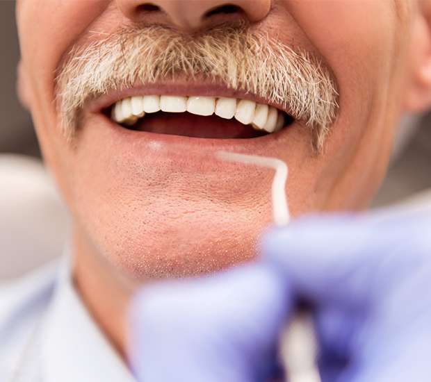 Pittsburgh Adjusting to New Dentures