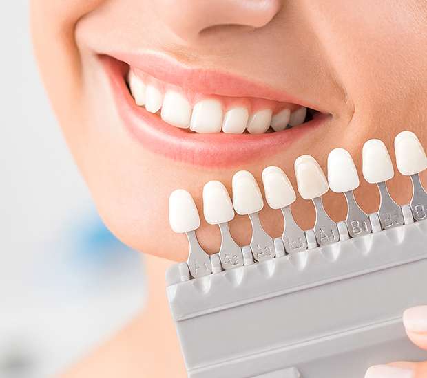 Pittsburgh Dental Veneers and Dental Laminates