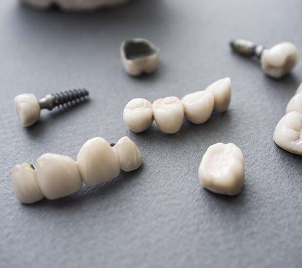 Pittsburgh The Difference Between Dental Implants and Mini Dental Implants